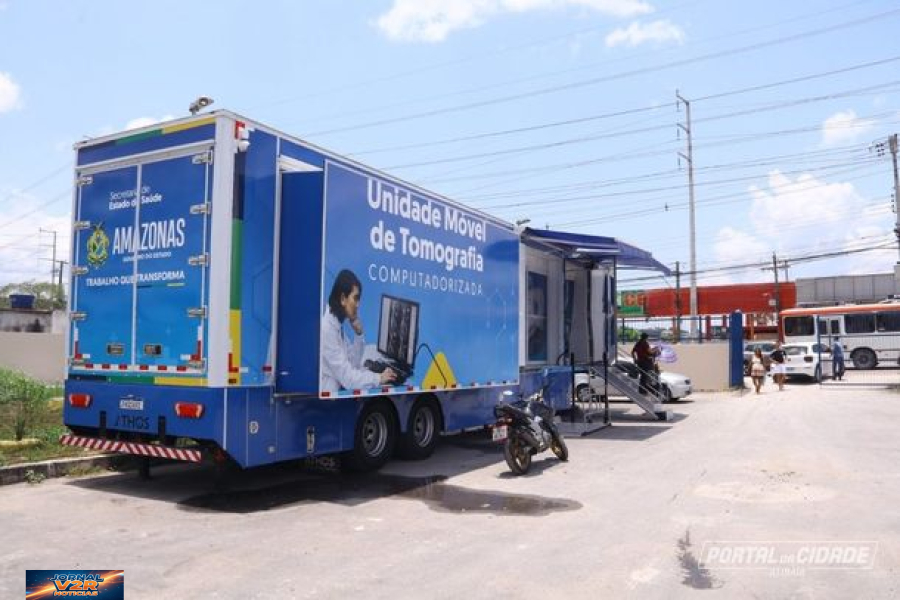 Carreta da tomografia começa atendimentos do SUS em Atibaia para reduzir fila de exames