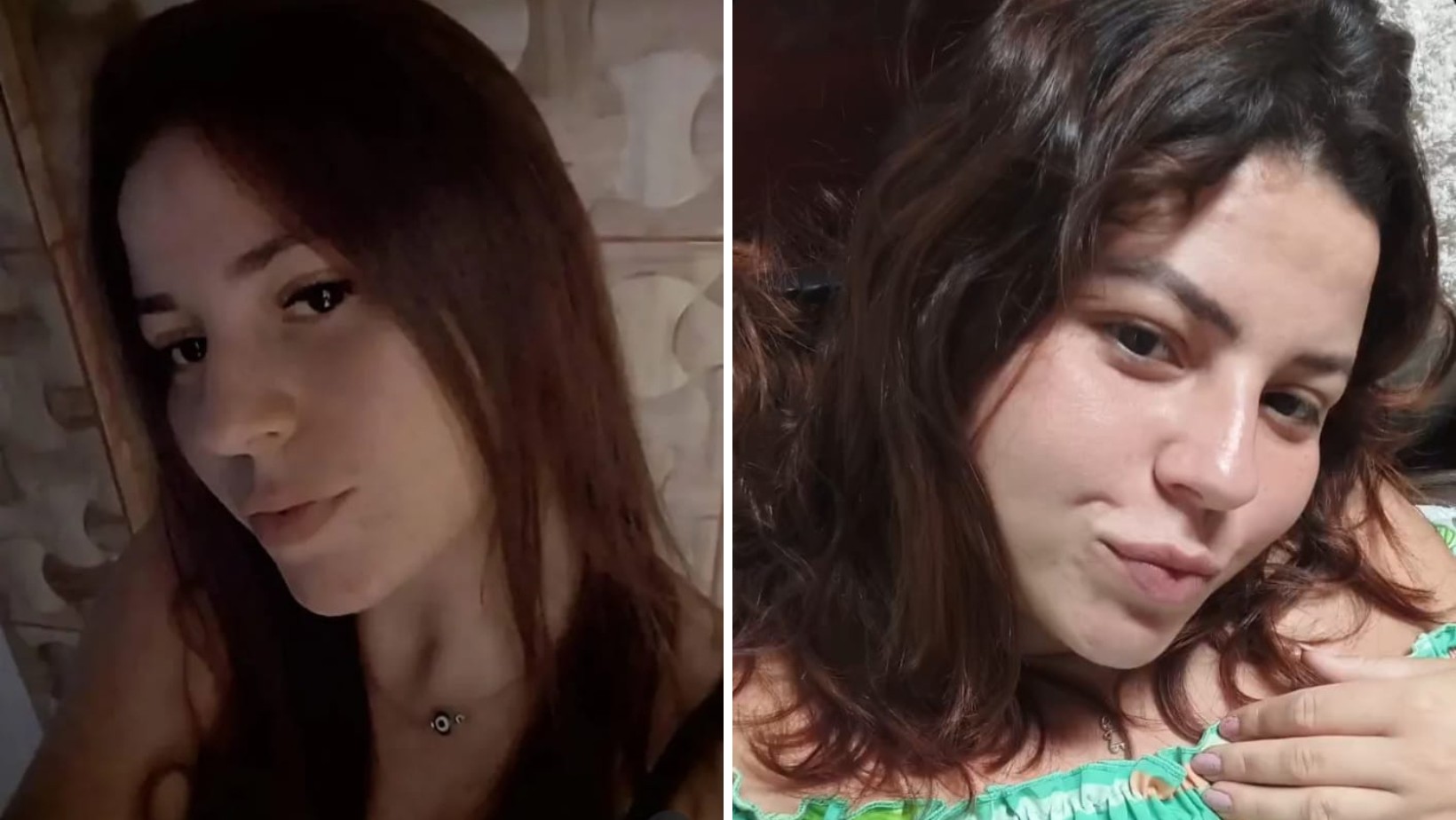 Jovem que teve corpo queimado pelo ex-companheiro em Ubatuba será transferida para unidade de queimados em São José