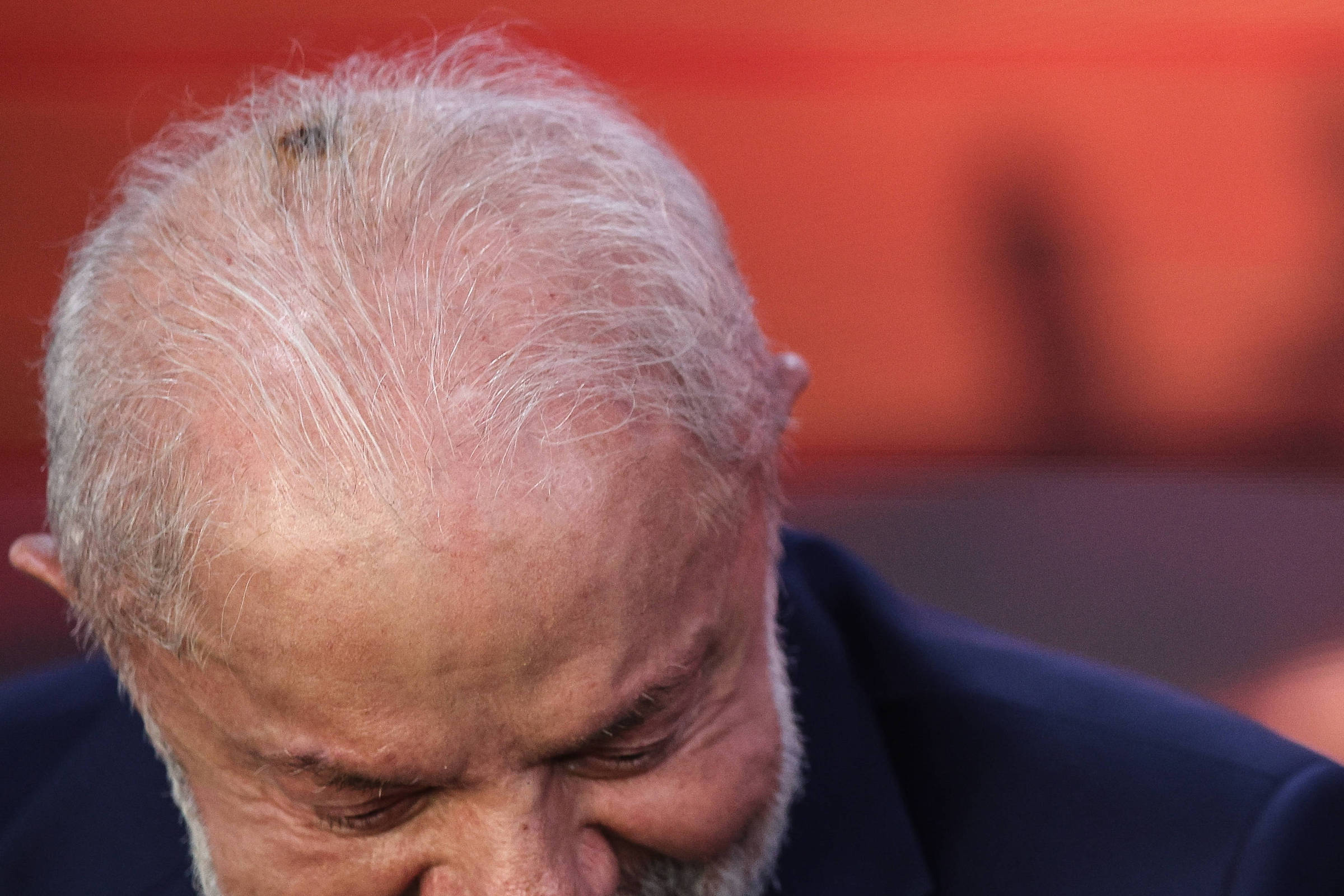 Lula passa por consulta em hospital após remover lesão de câncer de pele na cabeça