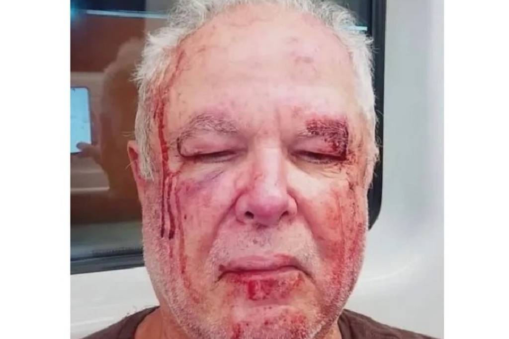 Polícia Civil investiga no Rio agressão a idoso que usava adesivo do PT