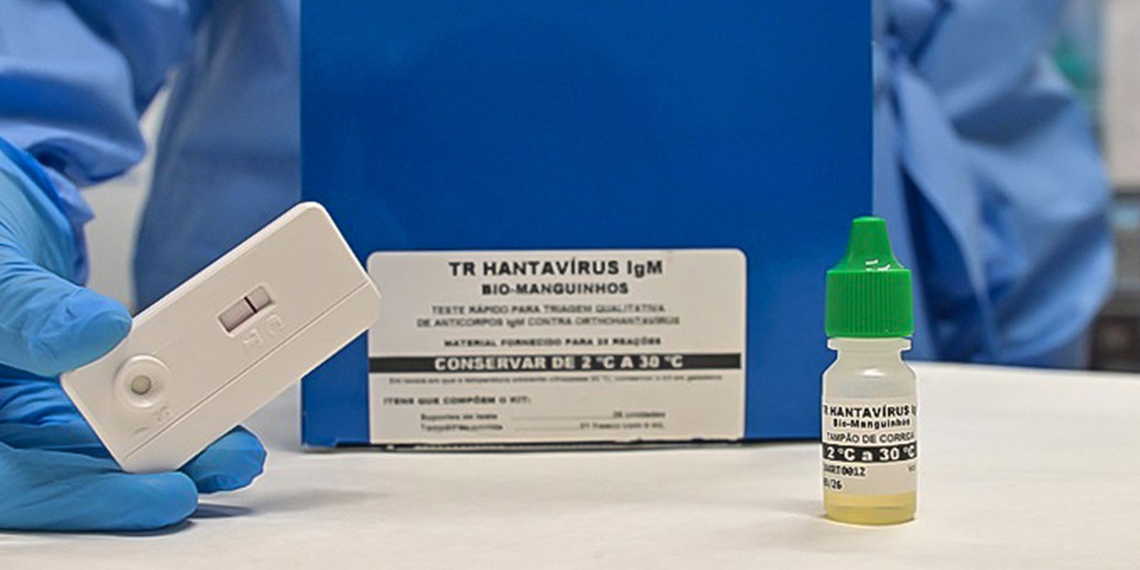 Novo teste faz diagnóstico de hantavirose em 20 minutos