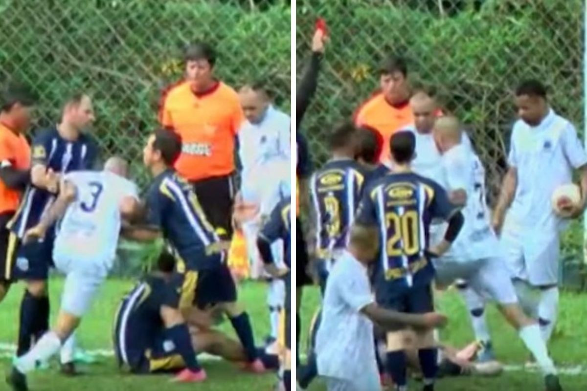 VÍDEO: Jogador é internado após levar chute no rosto e sofrer fraturas durante jogo amador em Bragança Paulista