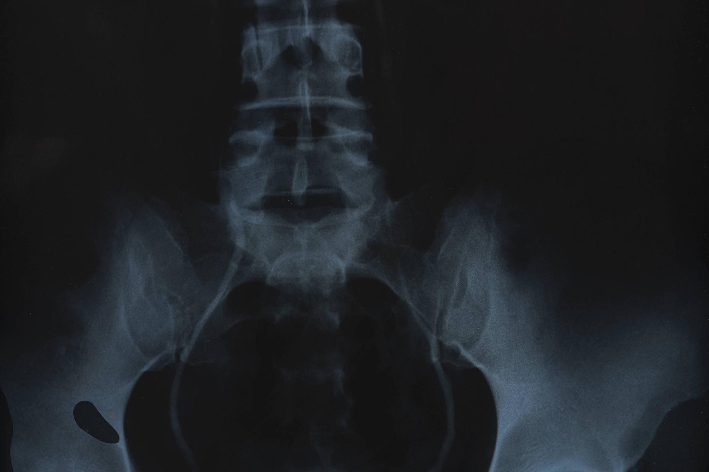 Anna Maria Maiolino ganha exposição em que usa a arte para radiografar o corpo