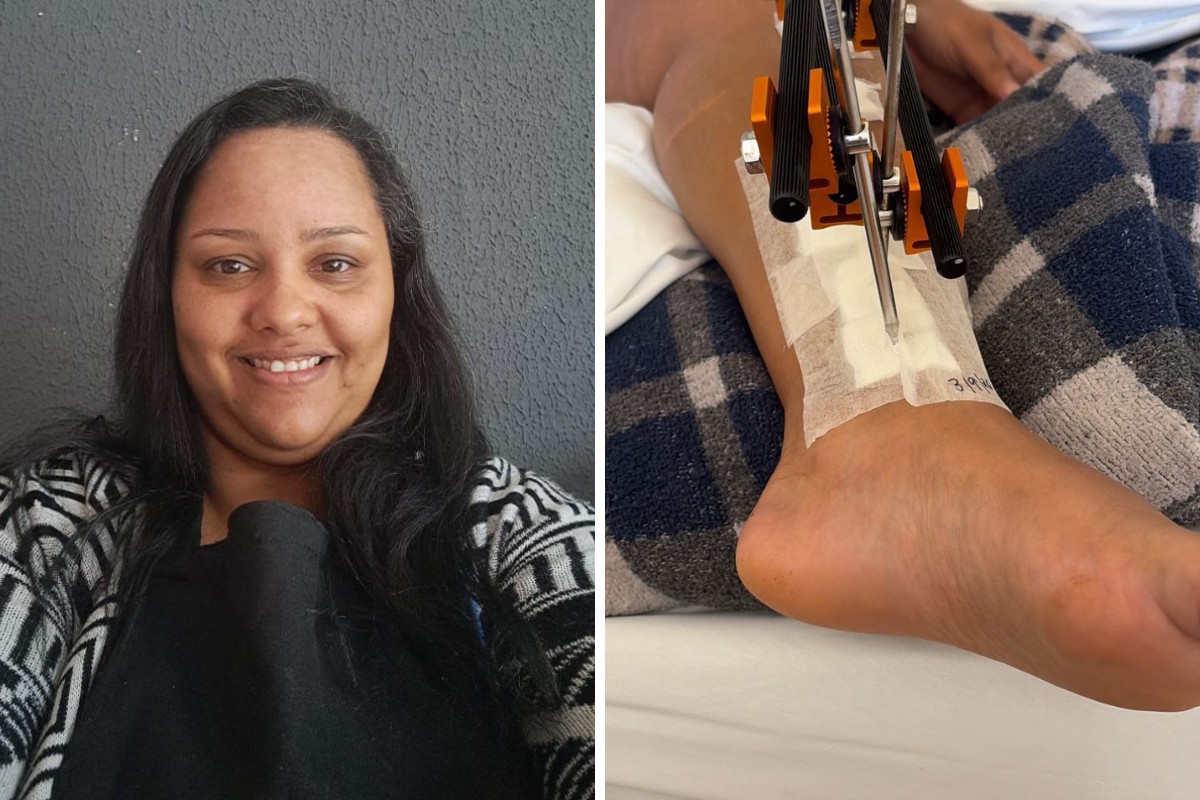 Cabeleireira baleada ao voltar do trabalho em SP confundiu tiros com barulho de moto: 'Muito rápido'