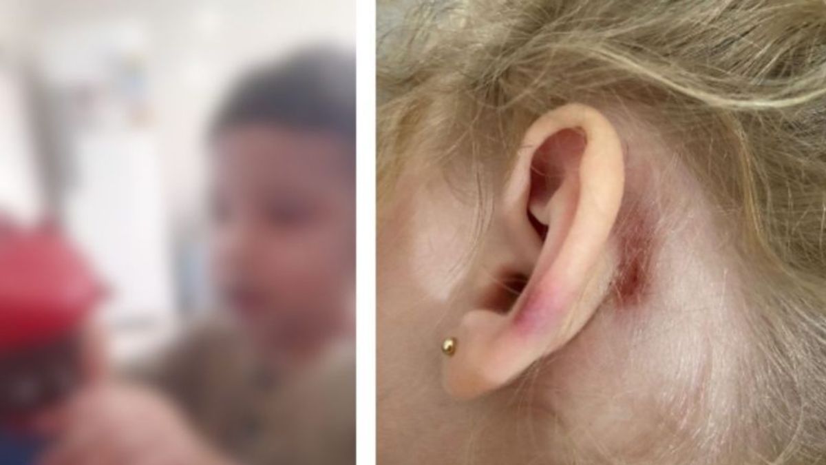 Socorro desliga servidoras investigadas por maus-tratos em creche municipal