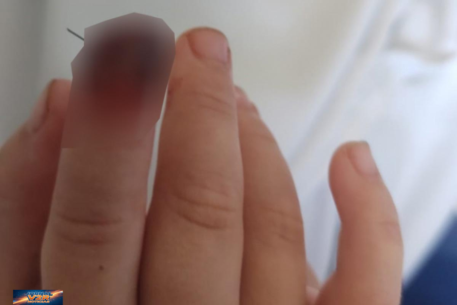 Porta de armário provoca acidente grave em creche de Taubaté e bebê pode perder parte do dedo