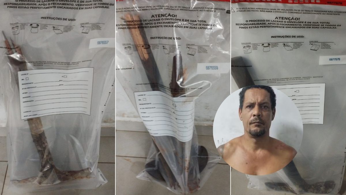 Homem tenta decepar mão da companheira durante ataque por ciúmes em Praia Grande