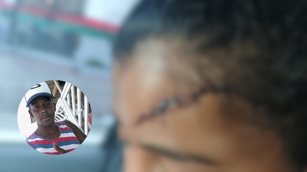 Foto mostra jovem ferida após ataque do ex em Praia Grande