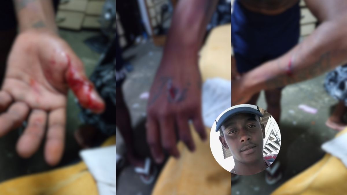 Homem preso por tentar matar a ex em Praia Grande deve alegar legítima defesa